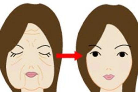 電波拉皮大概多少錢(qián)