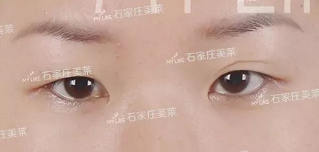 這些眼睛一點都不招人喜歡！