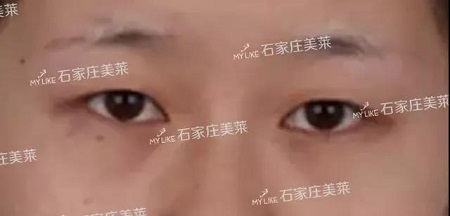 這些眼睛一點都不招人喜歡！