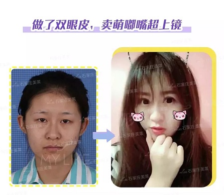 這些眼睛一點都不招人喜歡！