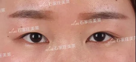 這些眼睛一點都不招人喜歡！