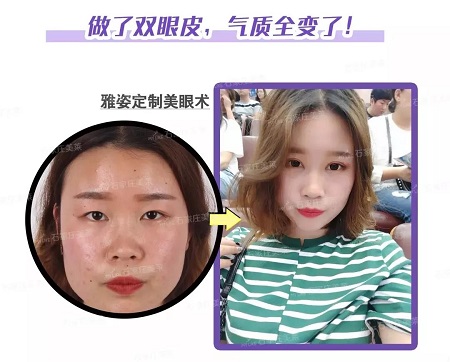 這些眼睛一點都不招人喜歡！