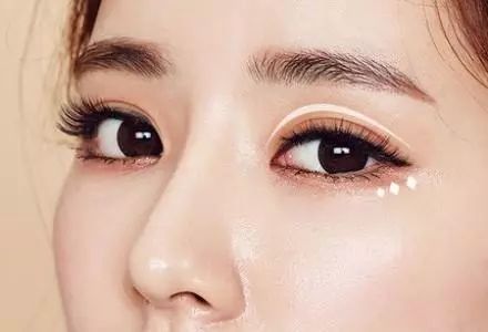 做個(gè)雙眼皮的價(jià)格要多少錢？
