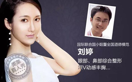  23-24日，韓國(guó)較會(huì)整容的柳元敏博士，來(lái)了！
