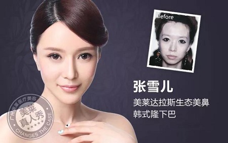 23-24日，韓國(guó)較會(huì)整容的柳元敏博士，來(lái)了！