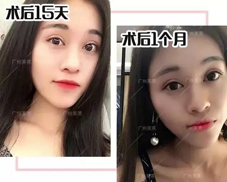這3種小眼睛開了眼角，電眼迷人1000倍！