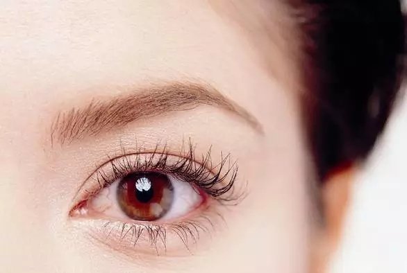 開(kāi)內(nèi)眼角多久可以恢復(fù)？