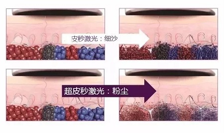 關(guān)于祛斑，可不能用美圖秀秀、輕顏相機(jī)、無(wú)他相機(jī)麻痹自己！