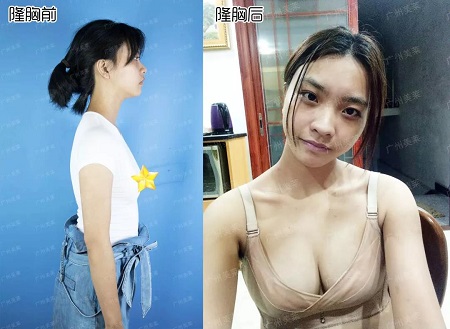 專業(yè)打假！所謂的豐胸秘籍是什么？！