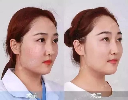 賦活水光3次399元、水光買一送一...春季水光專場，爆款限時搶！