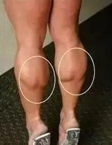 “腿精”不是你想做就能做的，你瘦腿了嗎？