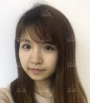 抗初老警報！萬物皆上漲、唯有臉下垂，你還說你不是老阿姨