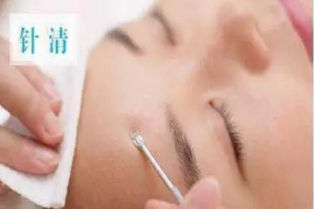 擠痘竟然被送進(jìn)ICU！你的痘痘還好嗎？