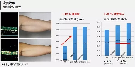 抗衰老的“水光”究竟為何飽受稱贊？