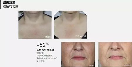 抗衰老的“水光”究竟為何飽受稱贊？