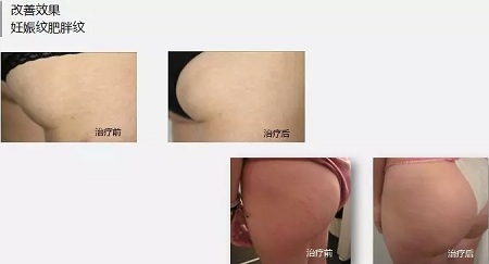 抗衰老的“水光”究竟為何飽受稱贊？