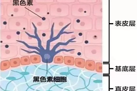 祛斑偏方“害死人”，小仙女們可長點心吧！