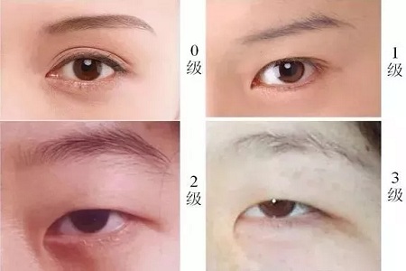 推薦這幾種增大眼睛的方法，除了開(kāi)外眼角！