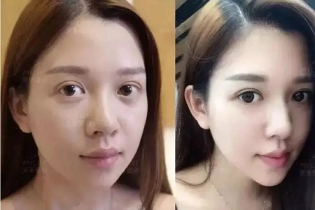 推薦這幾種增大眼睛的方法，除了開(kāi)外眼角！