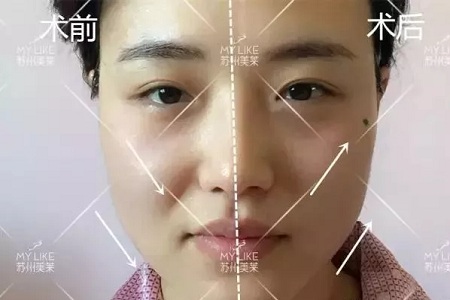 沒有誰能永遠年輕，不老都是保養(yǎng)的早！
