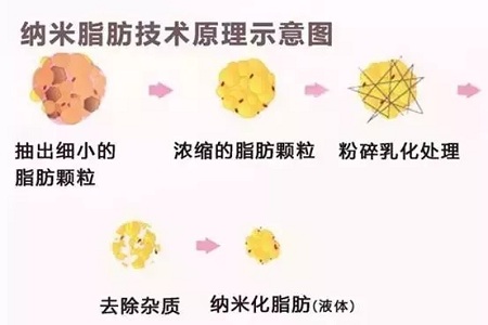 拿什么拯救你，我的黑眼圈？
