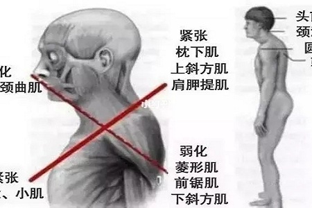 聽(tīng)說(shuō)很多不敢露胳膊的女生，胳膊上都有這個(gè)bug