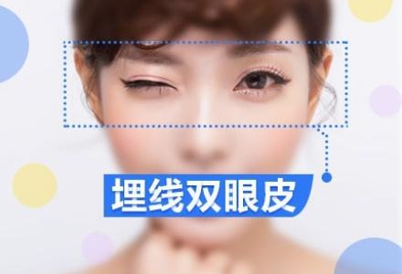 埋線雙眼皮價格