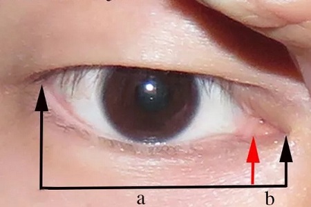 開眼角和不開眼角，差距有多大？