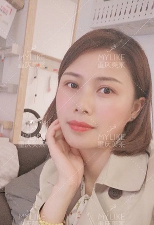 讓明星“一夜回春”的自體脂肪到底適不適合你？
