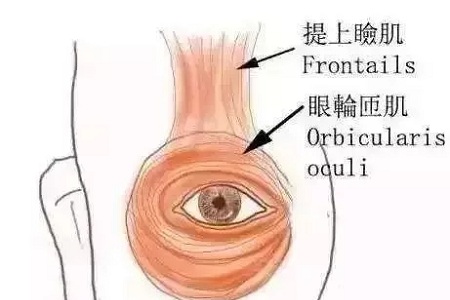 做了雙眼皮，醫(yī)師為什么建議要多睜眼？