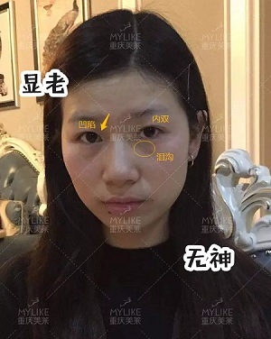 市面上五花八門的雙眼皮項目，如何有效找到你的菜？