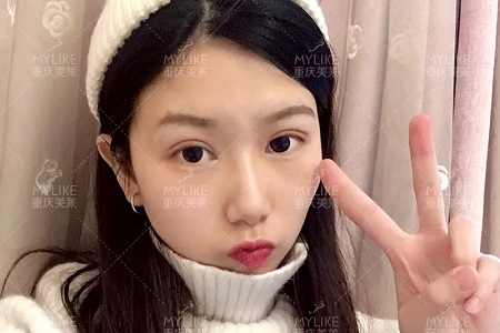 市面上五花八門的雙眼皮項目，如何有效找到你的菜？