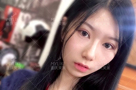 市面上五花八門的雙眼皮項目，如何有效找到你的菜？