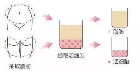 美萊實(shí)驗(yàn)室：當(dāng)顏值遇上“胸”霸，男人一般都會怎么選？