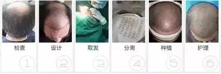 好看的皮囊千千萬，但都有一個共同點-頭發(fā)！