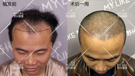 好看的皮囊千千萬，但都有一個共同點-頭發(fā)！
