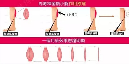這有一個(gè)快速又持久瘦小腿的方法！請(qǐng)注意查收！