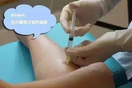 這有一個(gè)快速又持久瘦小腿的方法！請(qǐng)注意查收！