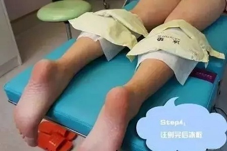 這有一個(gè)快速又持久瘦小腿的方法！請(qǐng)注意查收！