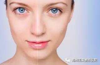25歲以后，這些醫(yī)美項(xiàng)目可比你們的所有護(hù)膚品都強(qiáng)！