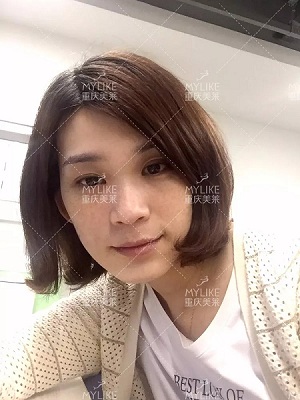 那個(gè)斑點(diǎn)女孩后來(lái)怎么樣了？
