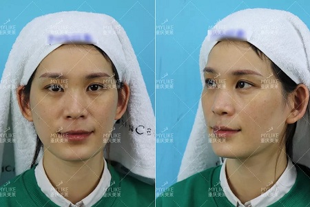 那個(gè)斑點(diǎn)女孩后來(lái)怎么樣了？