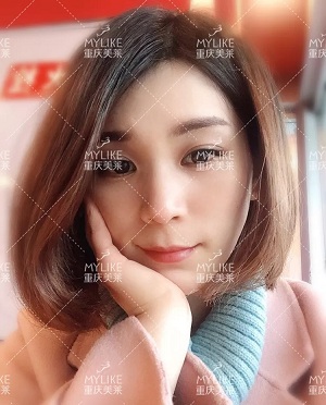 那個(gè)斑點(diǎn)女孩后來(lái)怎么樣了？