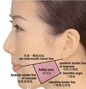 瘦臉會導致臉部凹陷松弛？