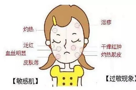 皮膚變成敏感肌怎么辦？如何修復(fù)敏感??？