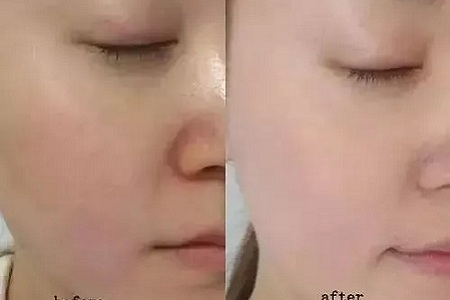 如何在炎熱的夏天，做清爽白凈的小姐姐？