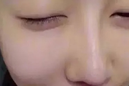 水光，打1次和4次究竟有多大區(qū)別？