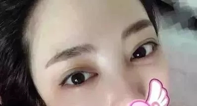 水光，打1次和4次究竟有多大區(qū)別？