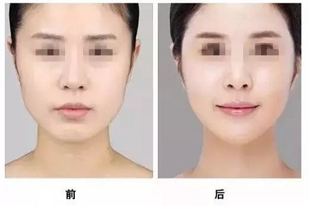 美萊實(shí)驗(yàn)室：瘦臉、ReFa都解決不了你的臉大問題交給我就對(duì)了