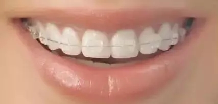 問診室：關于正畸，不止你想的這么簡單喔